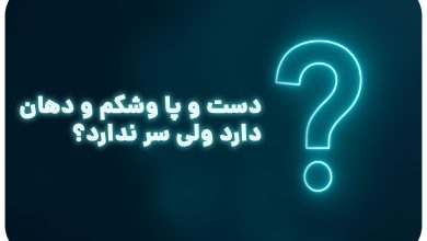 دست و پا وشکم و دهان دارد ولی سر ندارد