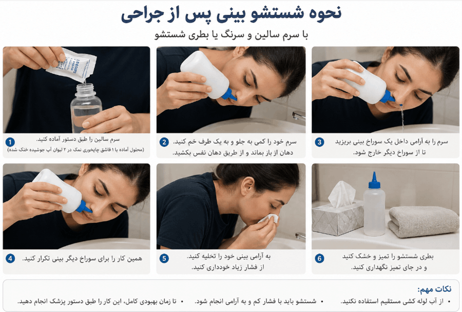 شستشو بینی